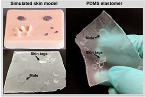 Hand holding examples of skin lesions