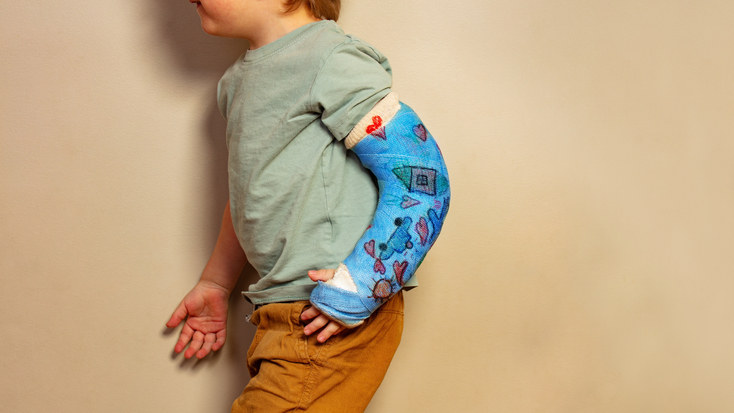 pediatric-ortho-education-cast-care-2173584353.jpg