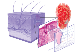 Inset_Innovation_Webinar_MatterSkin.png