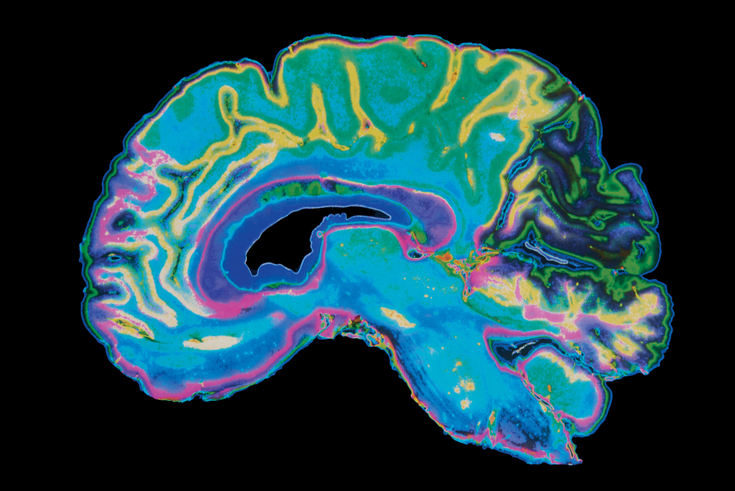 A colorful MRI scan of a human brain in profile against a black background.