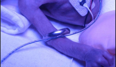 Keith’s wedding ring is shown around the arm of Brynn.