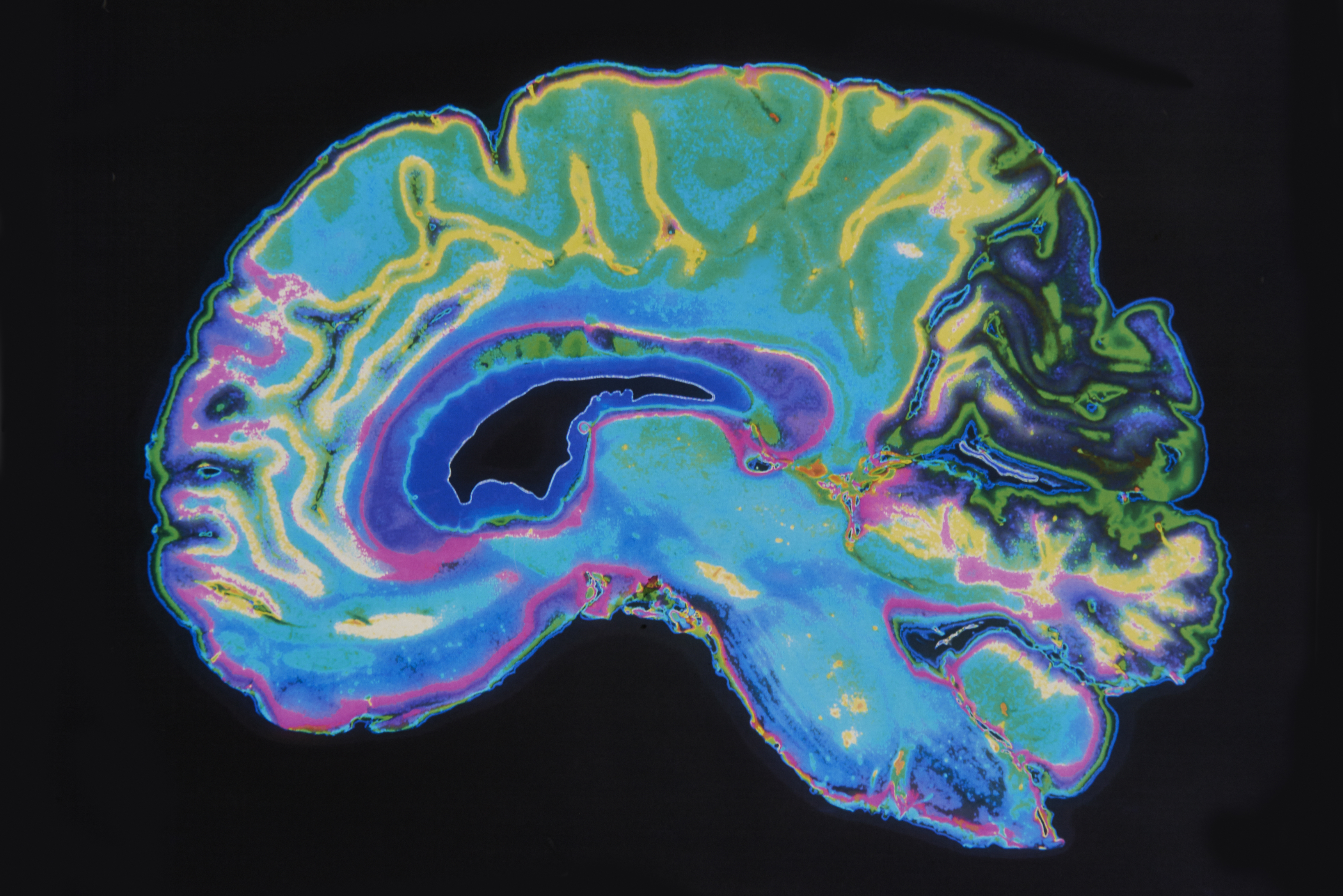 btc-foundation-brain-scan-future-beyond.jpg