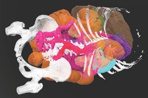 3D rendering of patient anatomy