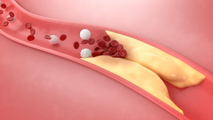 cvi-treat-disease.jpg