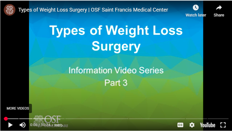 saint-francis-types-of-weight-loss-surgery-video-preview.png