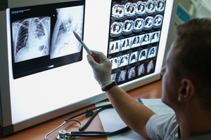 lung-radiologist.jpg__300x200_q100_subject_location-500,333_subsampling-2.jpg