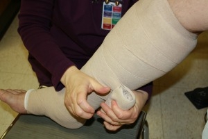 lymphedema therapy